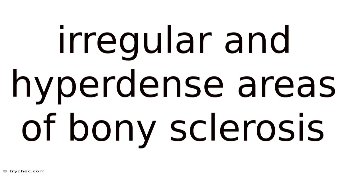 Irregular And Hyperdense Areas Of Bony Sclerosis