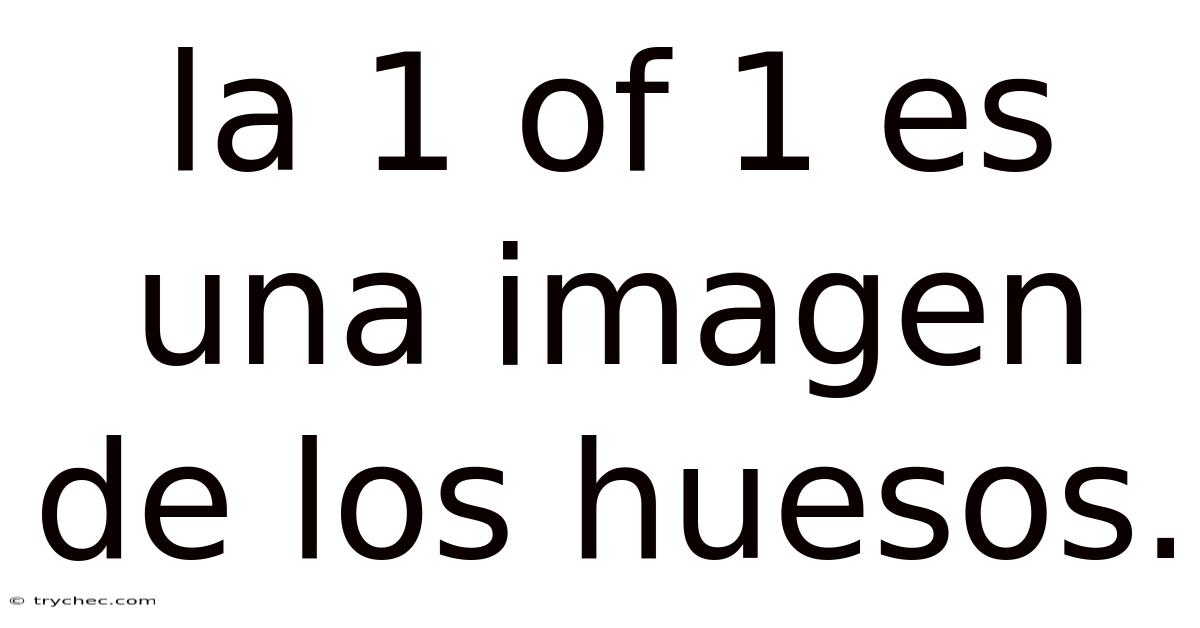 La 1 Of 1 Es Una Imagen De Los Huesos.