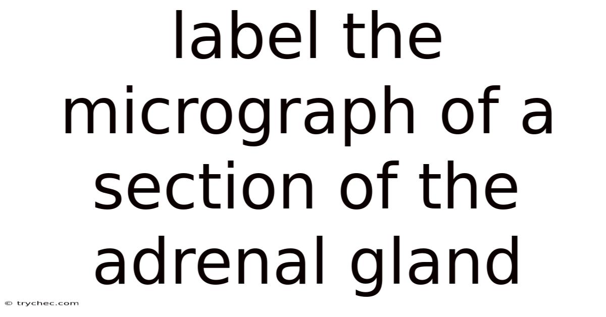 Label The Micrograph Of A Section Of The Adrenal Gland
