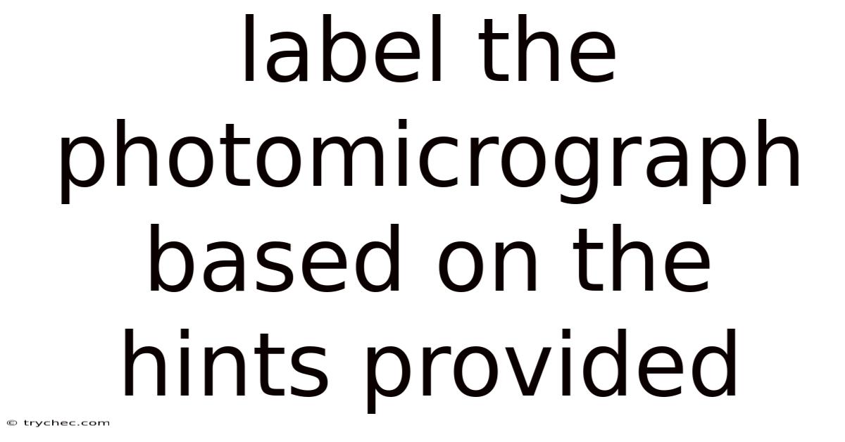 Label The Photomicrograph Based On The Hints Provided